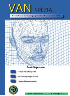 Facialisparese